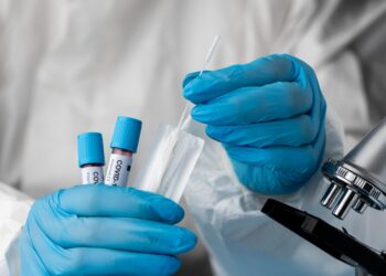 Reportan 126 contagios de COVID-19