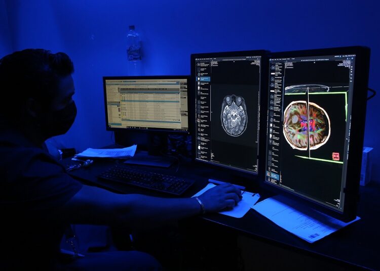 Issste aplica acciones preventivas para evitar enfermedad vascular cerebral