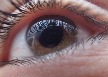 Glaucoma, miopía y retinopatía, principales problemas oftalmológicos en México