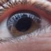 Glaucoma, miopía y retinopatía, principales problemas oftalmológicos en México