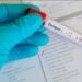 No hay personas hospitalizadas por dengue