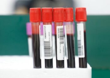 Reportan 16 casos de dengue y un deceso por COVID-19