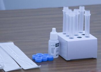 Reportan 35 casos de dengue y un deceso por COVID-19