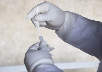 Reportan 26 casos de dengue y una defunción por COVID-19