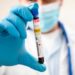 Reportan 2 hospitalizaciones por dengue