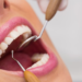 Prevención sigue siendo fundamental en odontología moderna