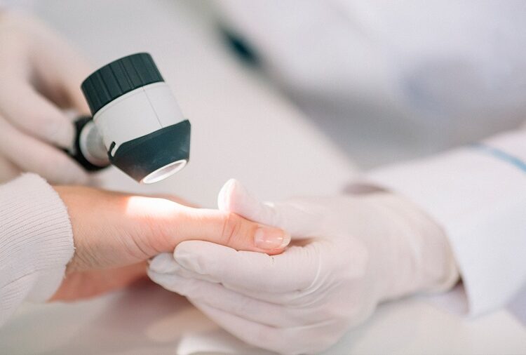 Salud realiza acciones de prevención contra la lepra