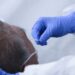 Reportan 5 personas hospitalizadas por COVID-19