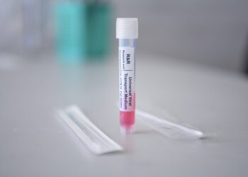 Reportan 6 personas hospitalizadas por influenza y 15 por COVID-19