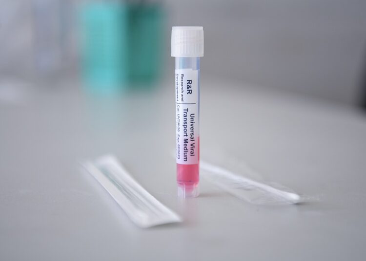 Reportan 6 personas hospitalizadas por influenza y 15 por COVID-19