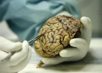 Científicos de Cuba y México desarrollan investigaciones para tratar el Alzheimer