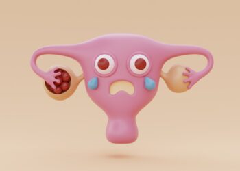 ¿Qué es el Síndrome de Ovario Poliquístico?