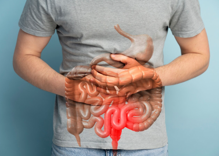 Uno de cada 10 hombres está en riesgo de padecer cáncer de colon