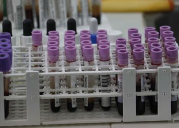 Autoridades paraguayas contabilizan casi 1.000 casos de varicela, un 75 % más que en 2023