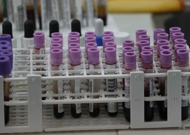 Autoridades paraguayas contabilizan casi 1.000 casos de varicela, un 75 % más que en 2023
