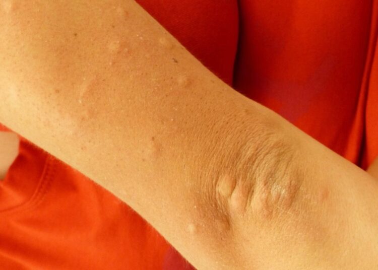 No se reportan casos de dengue en últimas 24 horas