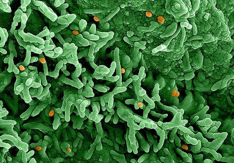 OMS declara mpox emergencia de salud pública internacional