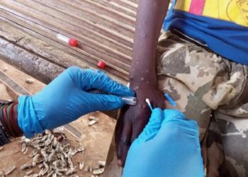 Descartan casos de mpox o viruela símica en Puebla