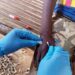 Descartan casos de mpox o viruela símica en Puebla