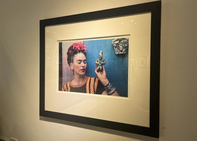 Diagnostican afectación de Frida Kahlo 70 años después: síndrome de cola de caballo