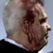 Concacaf investigará la agresión a Javier Aguirre en Honduras