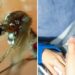 Puebla acumula 4 mil 206 contagios de dengue