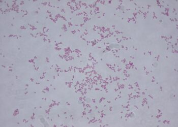 Confirman al menos 20 casos de menores infectados por bacteria Klebsiella oxytoca