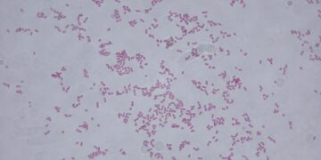 Confirman al menos 20 casos de menores infectados por bacteria Klebsiella oxytoca
