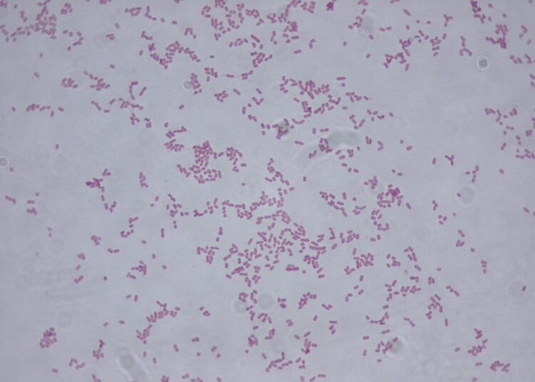 Confirman al menos 20 casos de menores infectados por bacteria Klebsiella oxytoca