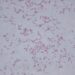 Confirman al menos 20 casos de menores infectados por bacteria Klebsiella oxytoca