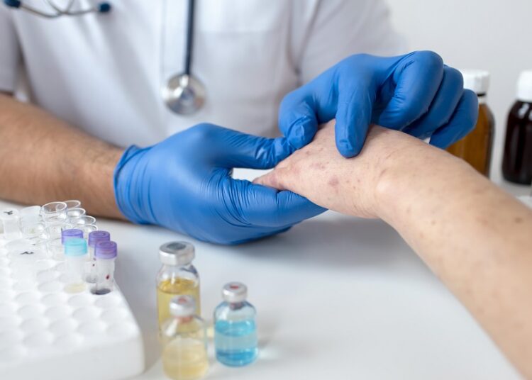 Issstep advierte sobre la detección oportuna de casos de lupus
