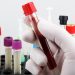 Importante detectar casos de Síndrome de Quilomicronemia Familiar