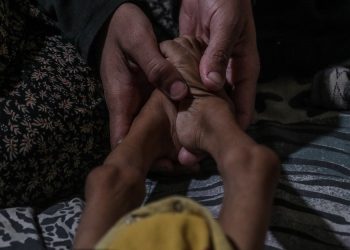 Más 250 palestinos han muerto por desnutrición en Gaza