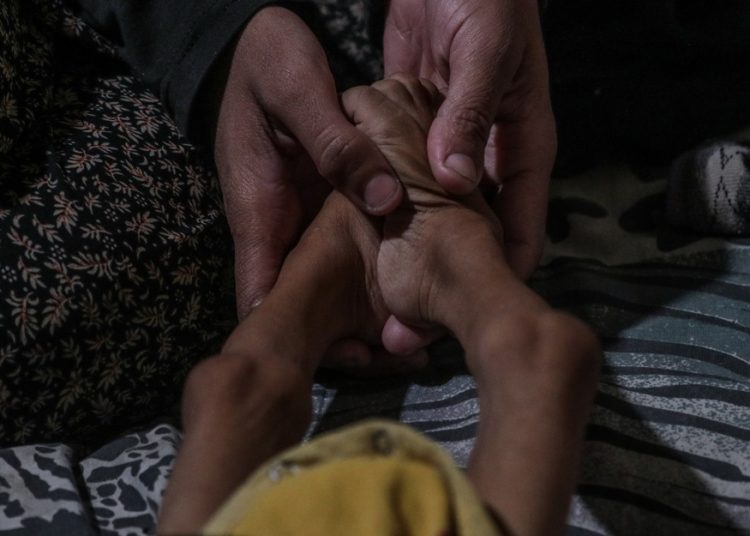 Más 250 palestinos han muerto por desnutrición en Gaza