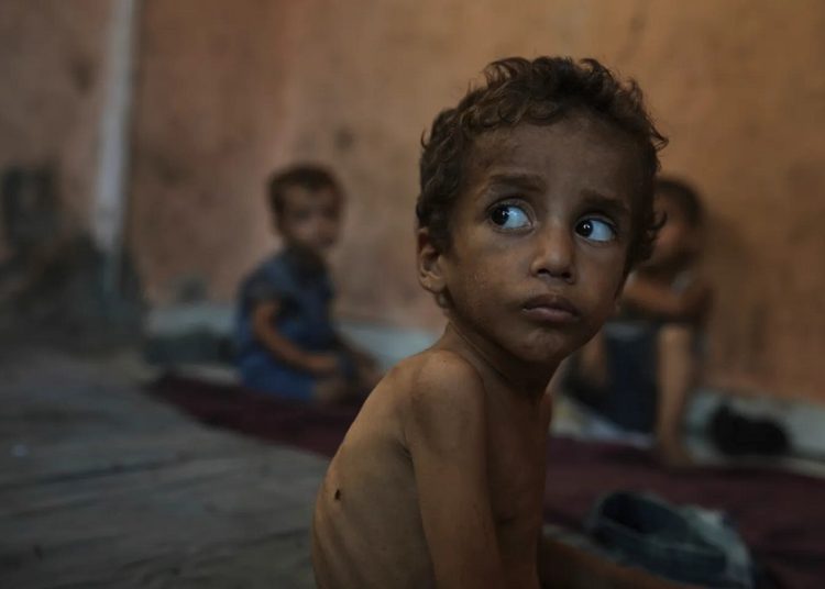 100 niños han muerto en Gaza por desnutrición desde el inicio de la ofensiva israelí