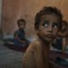 100 niños han muerto en Gaza por desnutrición desde el inicio de la ofensiva israelí