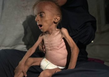 Gaza registra 10 muertos por desnutrición el viernes, 3 de ellos eran niños