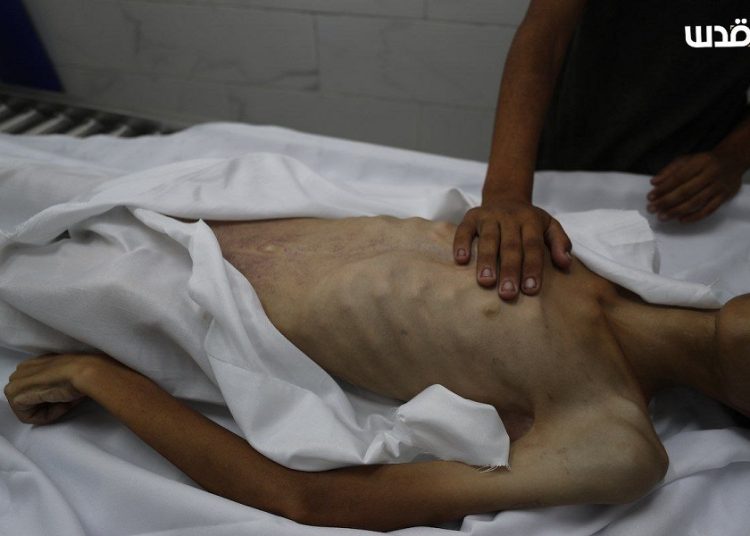 Gaza registra otras 6 muertes relacionadas con el hambre