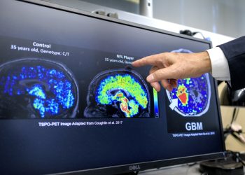 Científicos latinos en EE.UU. detectan biomarcador temprano de Alzheimer