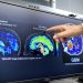 Científicos latinos en EE.UU. detectan biomarcador temprano de Alzheimer