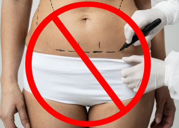 PVEM propone prohibir cirugías plásticas en menores de edad