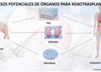 Órganos de cerdos trasplantados a humanos