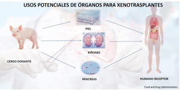 Órganos de cerdos trasplantados a humanos