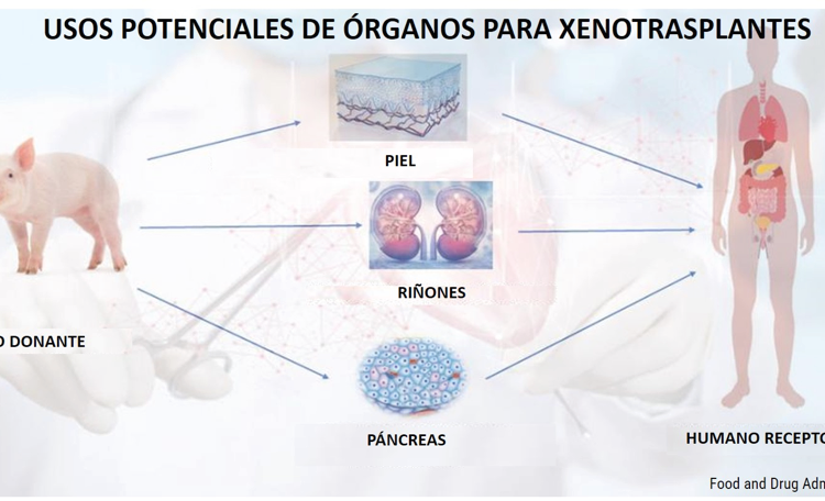 Órganos de cerdos trasplantados a humanos