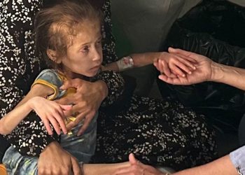 6 gazatíes mueren por desnutrición, entre ellos 2 niños