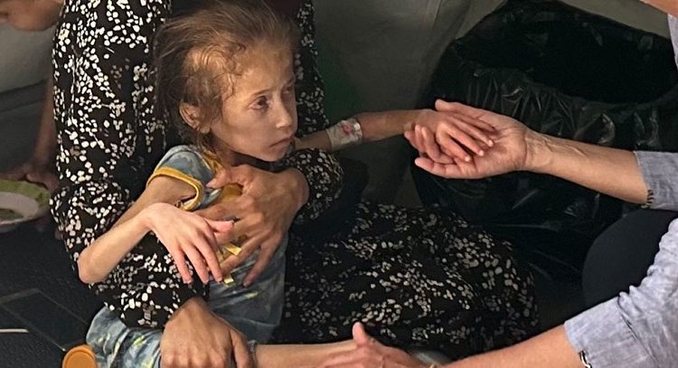 6 gazatíes mueren por desnutrición, entre ellos 2 niños