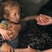 6 gazatíes mueren por desnutrición, entre ellos 2 niños