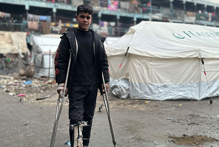 Al menos 21 mil niños gazatíes han quedado discapacitados