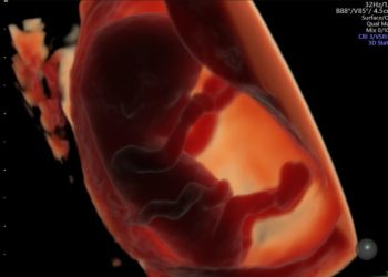 Consumir alimentos ultraprocesados afecta a la fertilidad humana