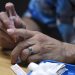 OPS pide reforzar medidas contra el sarampión
